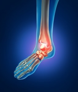 Heel Pain and the Holidays